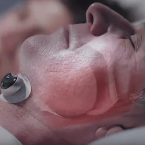 SleepLab™ – Official Retailer