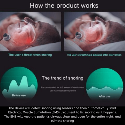 SleepLab™ – Official Retailer