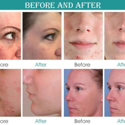 DermaLuminate™ Official Retailer – Professional Led Light Therapy