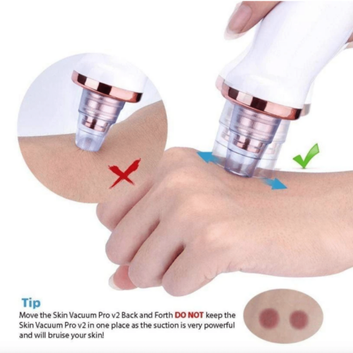 Modernmua™ Official Retailer – Skin Vacuum Pro V2