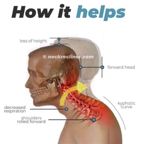 Neckrecliner® Official Retailer – Cervical & Thoracic Stretcher
