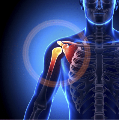 Shoulder Rehab™ Official Retailer – Orthopedic Brace