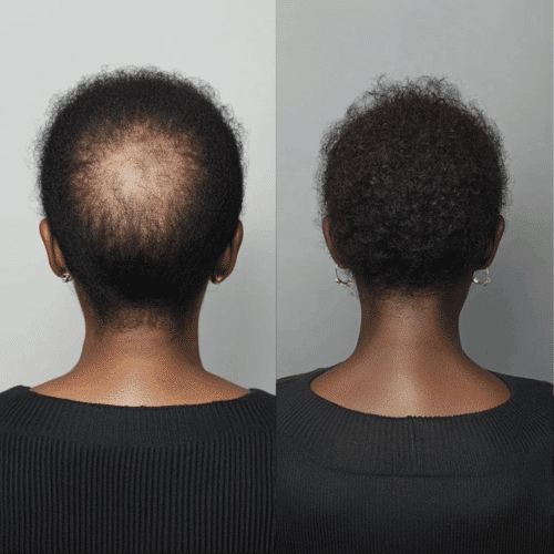 Follicle Activator 3.0 (Official Retailer) 2025