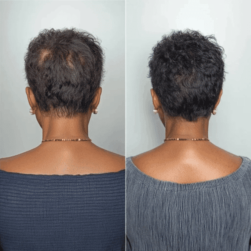 Follicle Activator 3.0 (Official Retailer) 2025