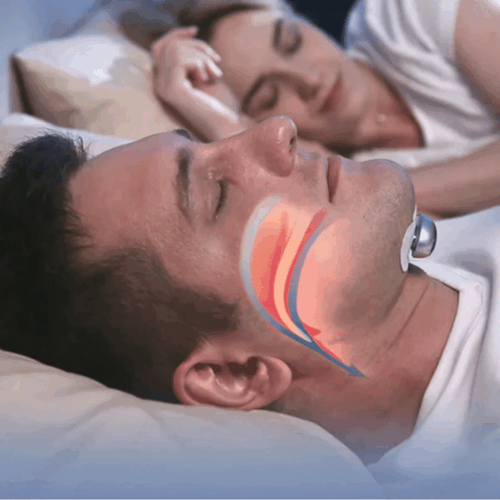 Z3 Pro (Advanced Anti-Snoring Device) - Official Retailer